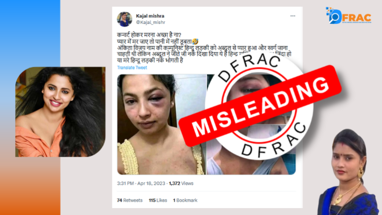 Malayalam Actor Anicka Vikhraman Accuses Ex Anoop Pillai of Assaulting Her, Shares Pics of Bruises