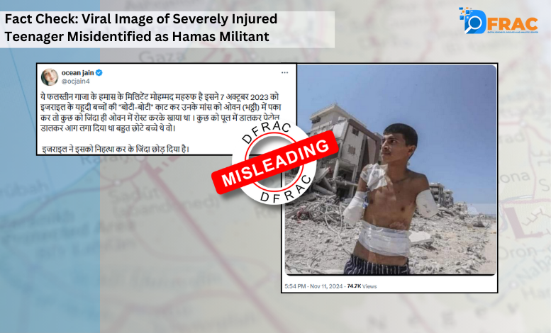 Fact Check: Viral Image of Severely Injured Teenager Misidentified as Hamas Militant